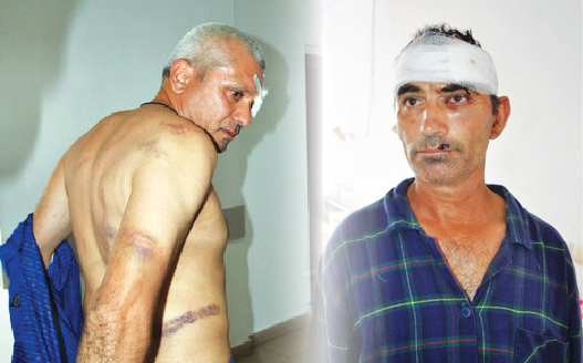 IPJ a deschis dosar penal pentru minerii bătuţi la Cariera Poiana