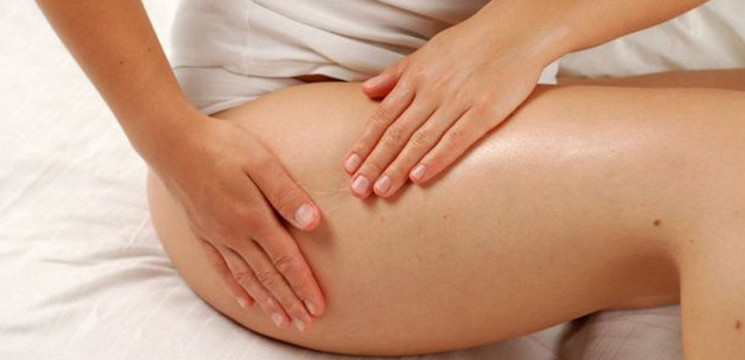 Viaţa sănătoasă – Vergeturile, de ce apar și cum le putem trata?