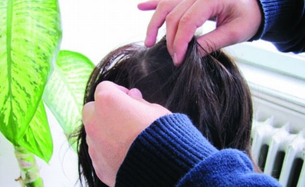 Sute de elevi din Gorj, cu micoze şi păduchi