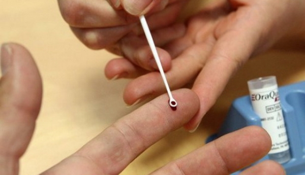 Gorjenii aflaţi în vacanţă pe litoral se pot testa gratuit pentru depistarea infecţiilor cu HIV şi cu virusurile hepatice B şi C