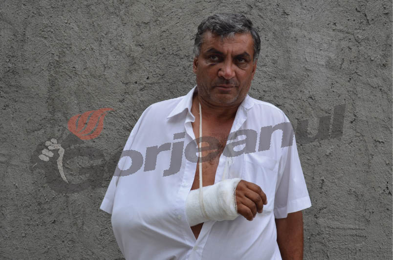 Boboc din Frânceşti, lovit cu lopata şi băgat în ghips! – Soţul procurorului DNA Dumitrache, cercetat pentru lovire şi alte violenţe