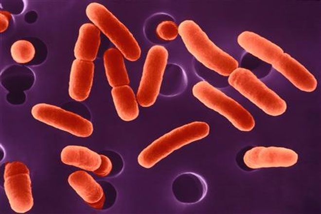 Bacteria E. coli, în atenția specialiștilor în sănătate