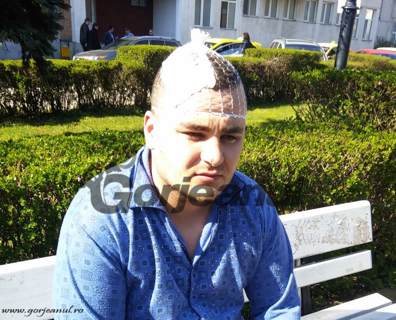 Bătut cu bâta de baseball