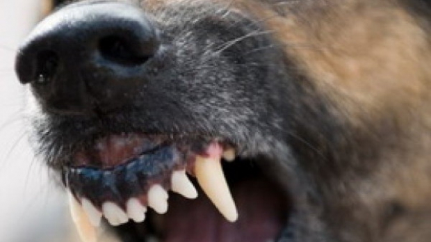 Elev mușcat de un câine, în curtea școlii