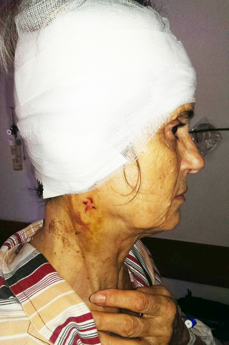 Profesoara primarului Mazilu, sfâșiată de un rottweiler chiar lângă Leagănul din Cărbunești