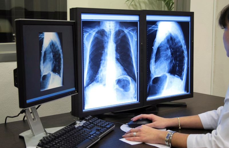 Post vacant de asistent la Laboratorul de Radiologie