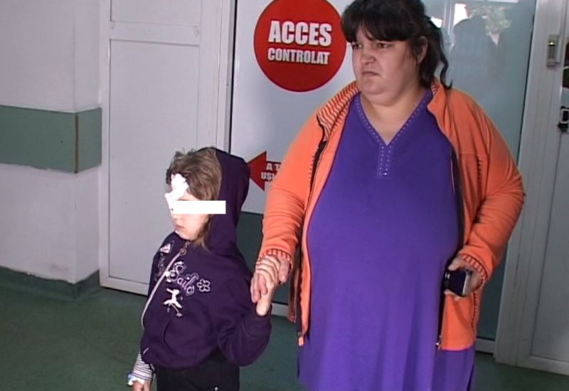 Fetiţă din Târgu-Jiu, muşcată în zona feţei de un câine maidanez