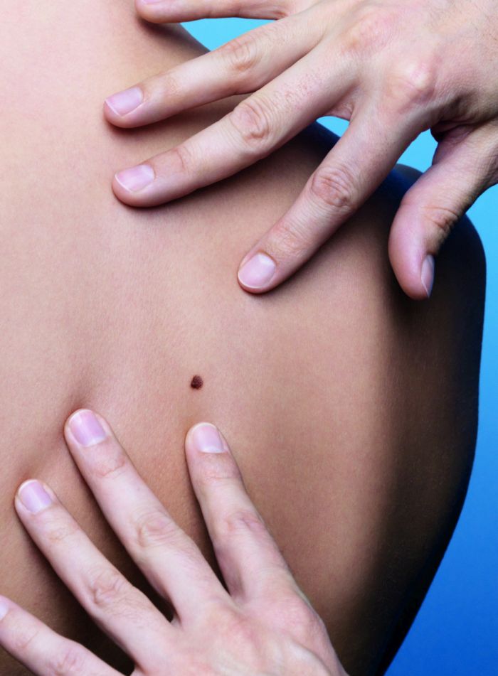 Campania de testare a aluniţelor suspecte este în plină desfăşurare