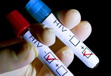 Indemnizații de hrană în valoare de 22.740 de lei pentru 48 de gorjeni cu HIV