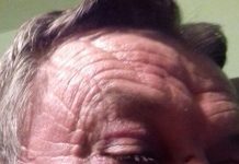 Localnic din Bustuchin, agresat de vecin pentru nişte găini! Lovită cu pumnii şi picioarele, victima însângerată a ajuns pe patul de spital