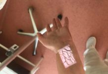 Spitalul Novaci s-a dotat cu un dispozitiv inteligent de vizualizare a venelor