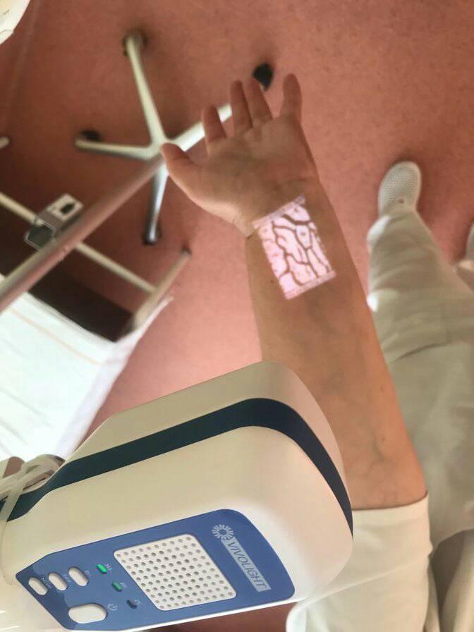 aparat vizualizare vene (4)