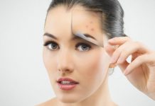 Sfaturi pentru a scăpa de punctele negre