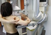 Ecografii mamare gratuite, pentru femeile din zona Negomir-Rovinari