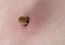 Gorjenii ajung zilnic la UPU Târgu-Jiu pentru înlăturarea căpușelor