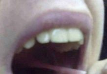 Candidatul sau gâlceava prostului cu lumea!