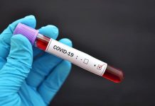 Covid 19: 832, record de morţi în Spania