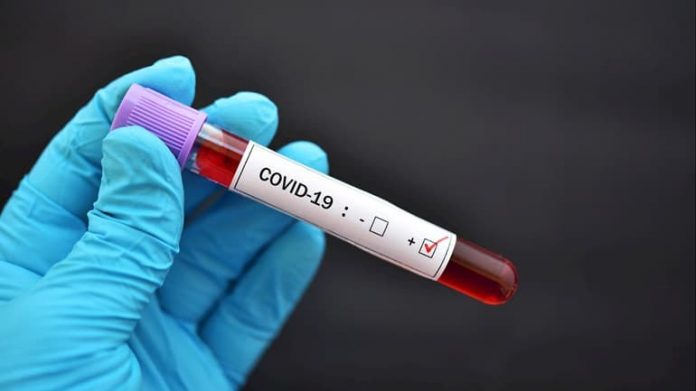 84094040_229281081524906_4330974867290587136_n