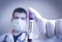 12 români au murit de Covid-19 în afara țării