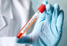 Gorj: 65 cazuri de COVID-19