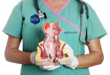 Hemoroizii si fisurile anale: ce sunt si cum se pot trata fara durere si operatie.