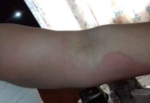 Secretara viceprimarului Aurel Popescu, afectată de un dezinfectant folosit în primărie