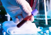 Aproape 1.000 de noi cazuri de Covid-19