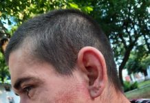 Bătut de polițiști și jandarmi. Urma bocancului – pe fața victimei!