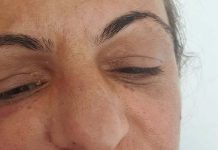 Femeie desfigurată de soțul de care divorțează! Agresorul nu a fost reținut