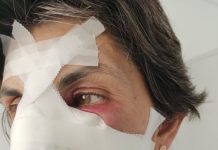 Leziuni traumatice, produse cu un corp dur! 16-18 zile de îngrijiri medicale pentru victima lui Vîlceanu