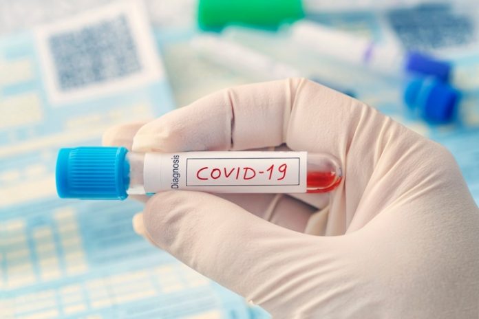test-covid-coronavirus-3