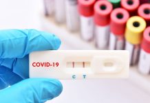 Sub 1.000 de noi cazuri de Covid