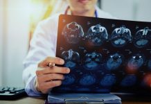 Lămâie sau banană? Neurologii nu doresc să le vadă pe imaginile de CT cerebral!