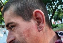 Cauza brancardierului cu bocancul imprimat pe față, disjunsă de Parchetul Militar! Cinci jandarmi, scoși din cauză, trei polițiști și fiul patronul Clubului ,,Babylon”, cercetați