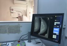 Mamografii 3D la Spitalul Județean