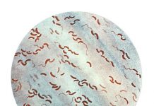 OMS: Pericol de holeră la Marea Neagră!