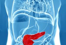 Câți gorjeni suferă de cancer pancreatic