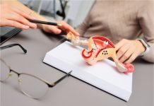 Cancerul ovarian – simptome, cauze, tratament