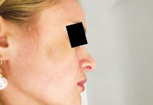 Arestat la domiciliu după ce și-a bătut fosta parteneră!