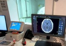 Zeci de pacienți cu AVC, salvați cu ajutorul trombolizei. Gorjul, pe primul loc în Oltenia!