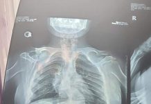 Strigăt de ajutor pentru o adolescentă din Bengești-Ciocadia