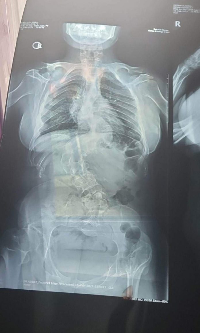 Strigăt de ajutor pentru o adolescentă din Bengești-Ciocadia