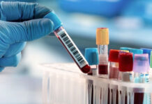 Spitalul Județean cumpără reactivi de 3 milioane de euro