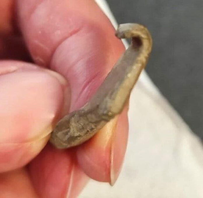 Piese romane din categoria Tezaur, descoperite în Gorj!